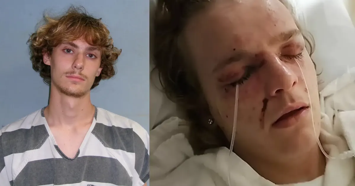 Autistic Texas teen facing blindness after ‘friend’ hurls de-clogger in his eyes: police
